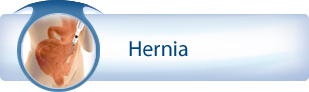 Hernia