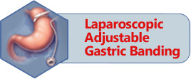 Laparoscopic Adjustable Gastric Banding