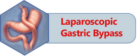 Laparoscopic Gastric Bypass