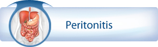 Peritonitis